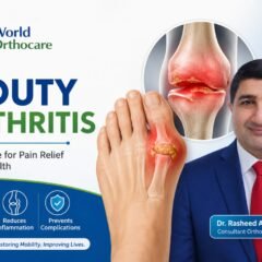 Gouty Arthritis