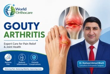 gouty arthritis-worldorthocare clinic -condtions we treat